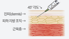 피하주사는 주사기를 45˚ 각도로 삽입해 진피(dermis)를 지나 피하 지방 조직에 놓는 주사이다.