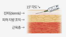 피내주사는 주사기를 15˚ 각도로 삽입해 가장 위 표면인 진피(dermis)에 놓는 주사이다.